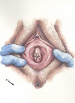 kønskrans vulva1